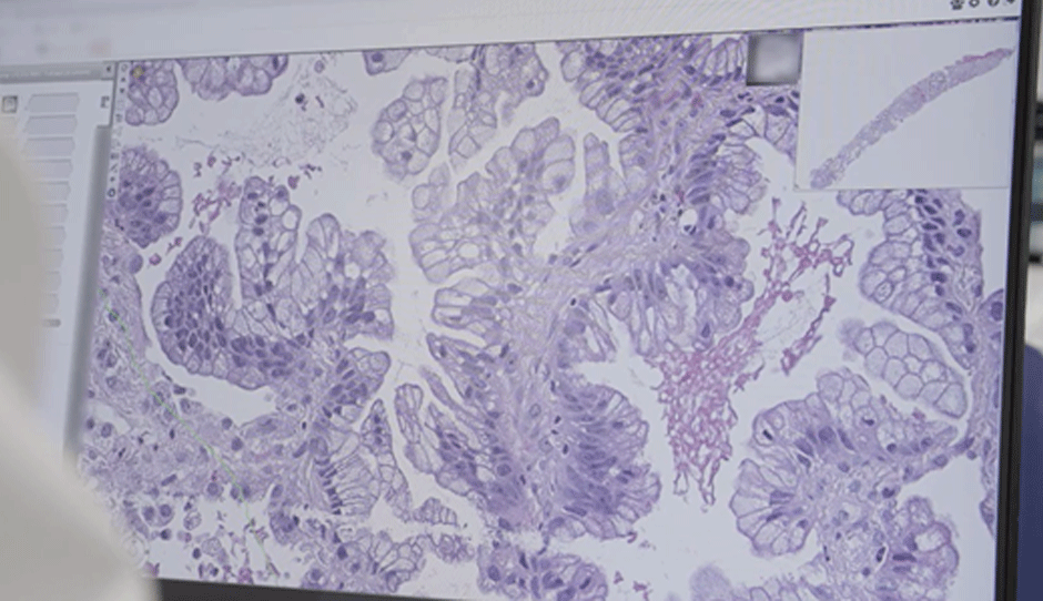 Pathology in action on a computer screen with scientist monitoring