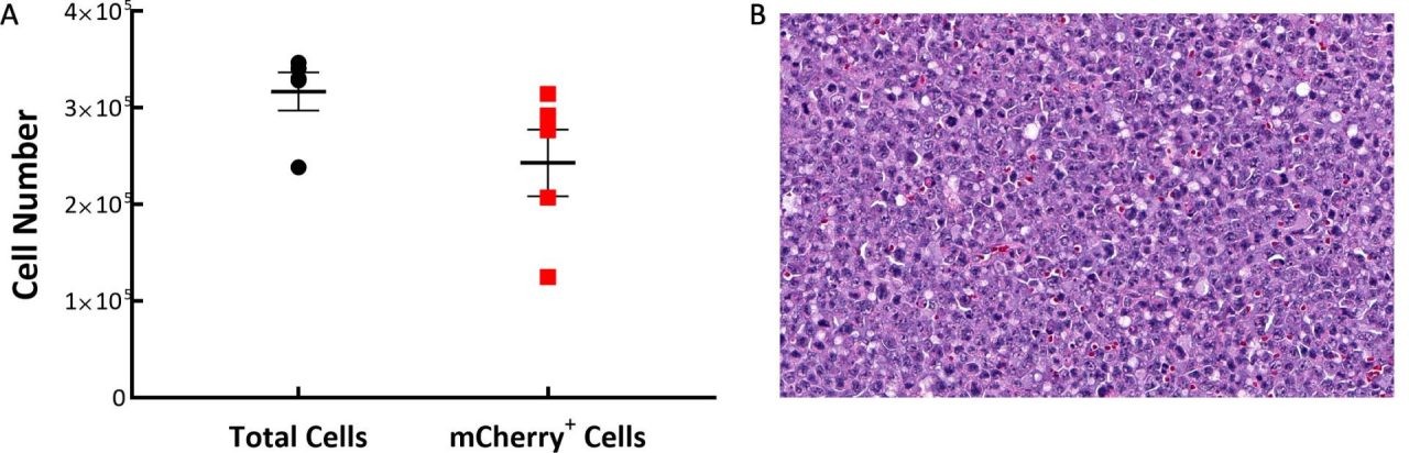 Abb. 1: C1498-Luc-mCherry-Tumorzusammensetzung in C57BL/6-Mäusen. A: Tumoren bestehen meist aus mCherry+-Zellen. B: Ein repräsentativer H&E-gefärbter Schnitt, der neoplastische Zellen mit pleomorphen Kernen und multiplen mitotischen Figuren zeigt, 20X Originalvergrößerung.