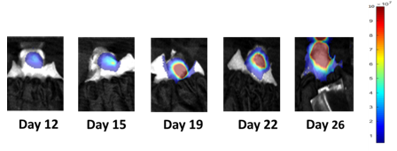 Bild 1: NCI-H1975-Luc repräsentative Bilder des Fortschreitens der metastasierten Gehirnerkrankung