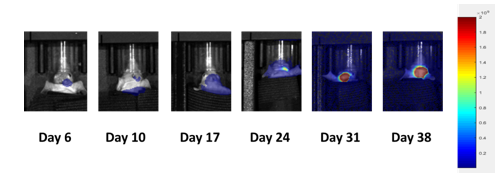 Bild 2: PC-9-Luc repräsentative Bilder des Fortschreitens der metastasierten Gehirnerkrankung