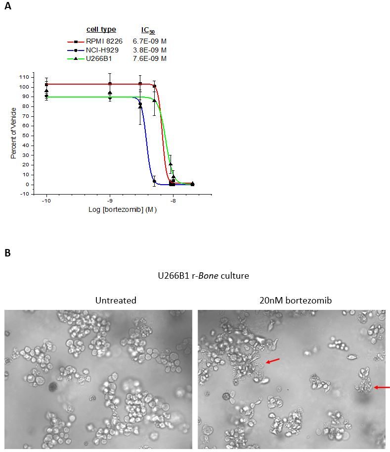 Figure 3: Bortezomib inhibition of myeloma cell proliferation in r-Bone culture