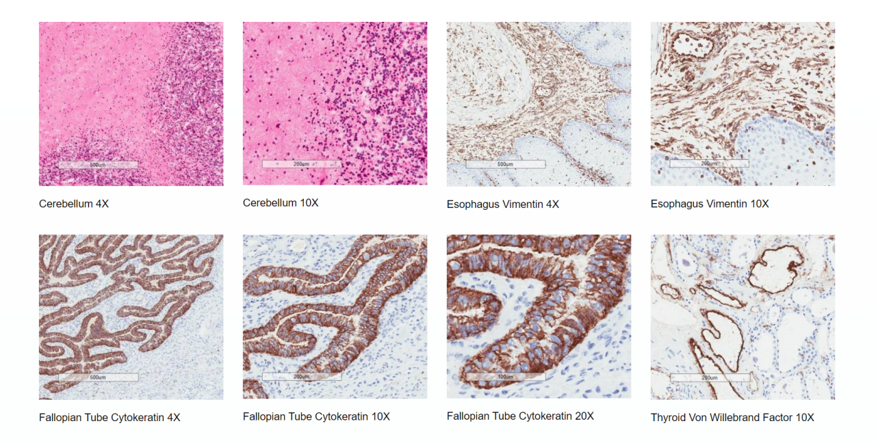 Frozen Human Tissue Quality Assessment Examples
